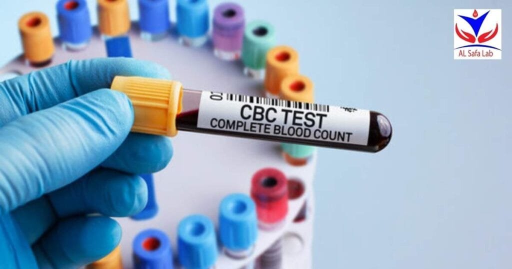 Complete Blood Count