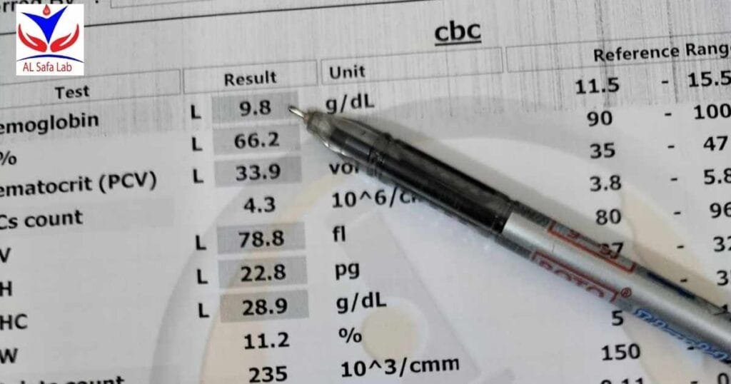 Complete Blood Count