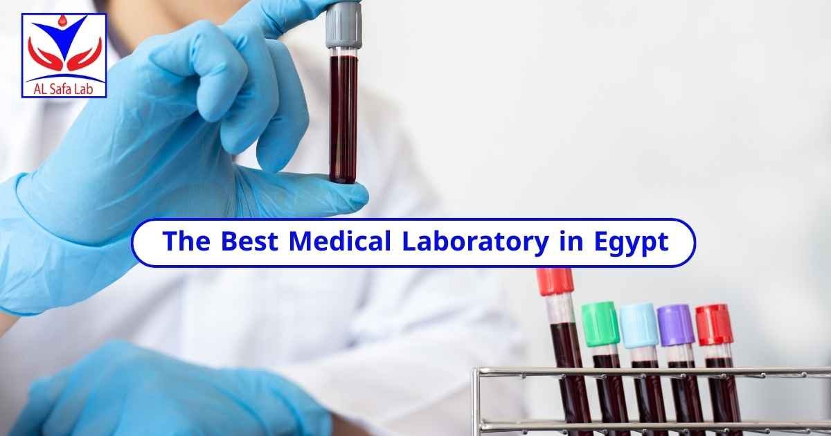 The Best Medical Laboratory in Egypt