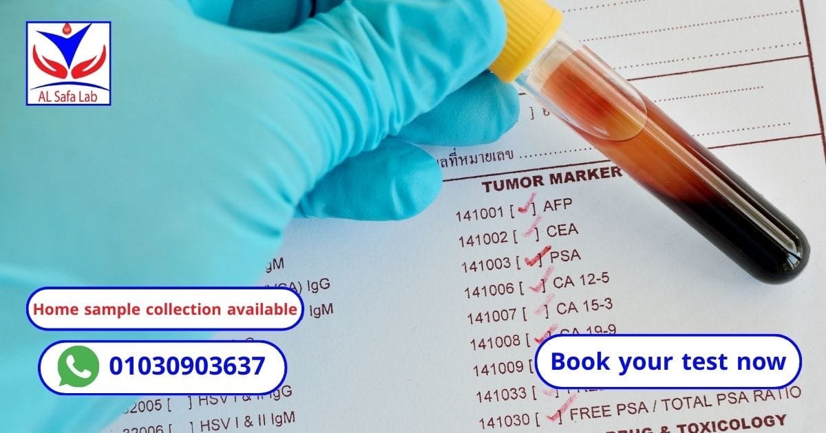 Tumor marker tests