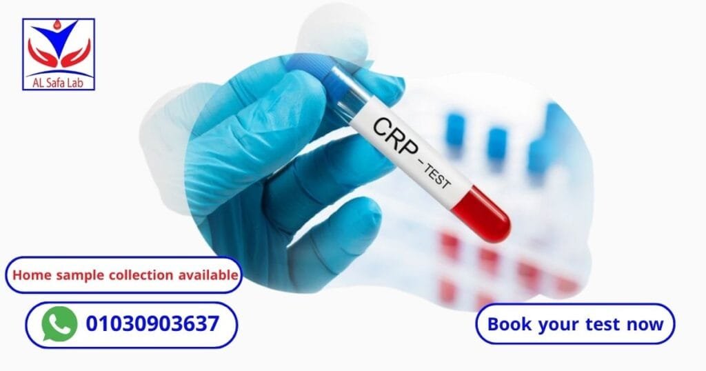 CRP Test