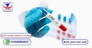 CRP Test
