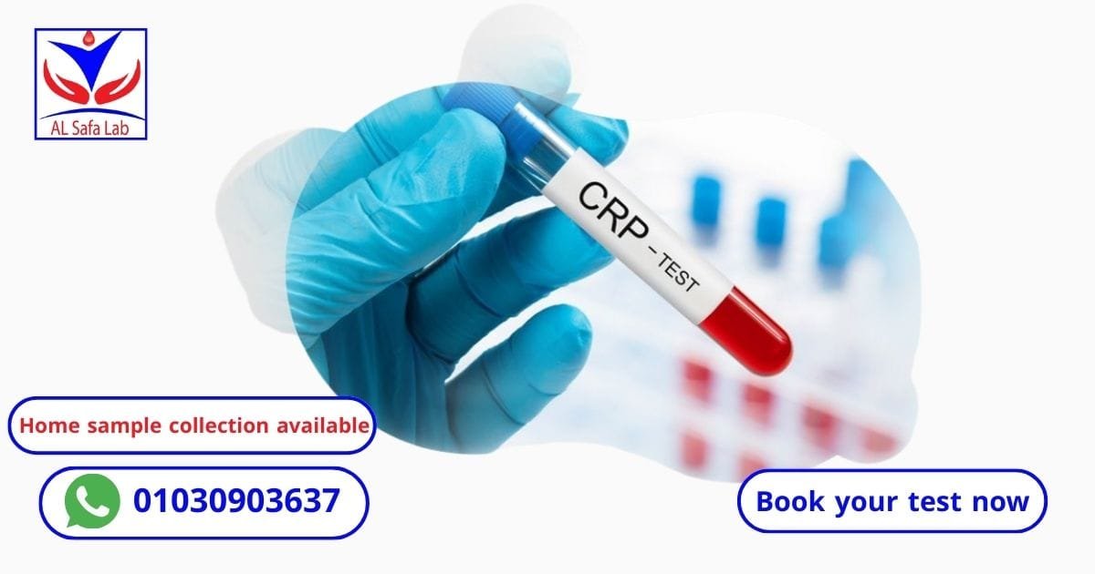 CRP Test