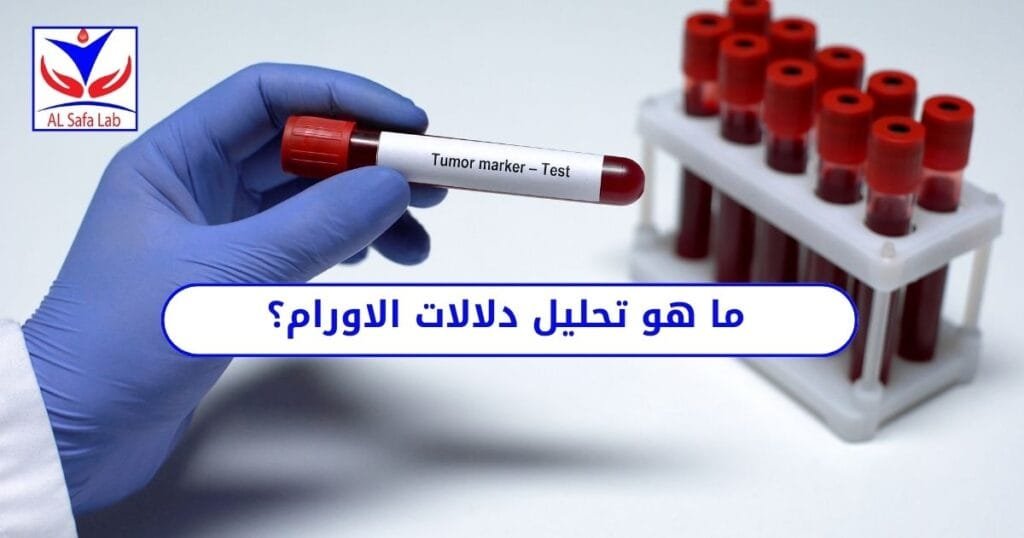 ما هو تحليل دلالات الاورام