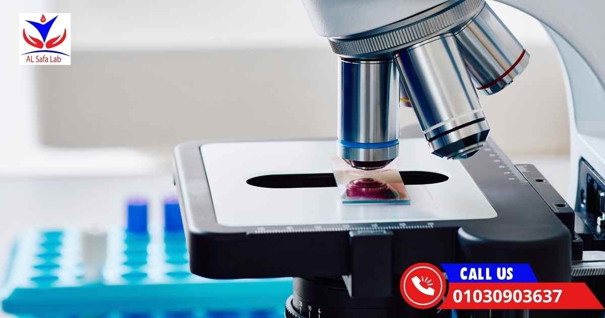 افضل معمل تحاليل في القاهرة (3)
