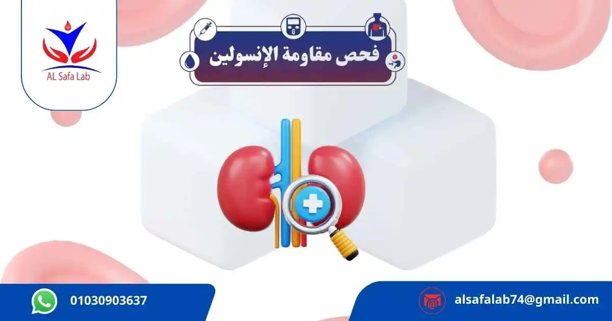 تحليل مقاومة الإنسولين