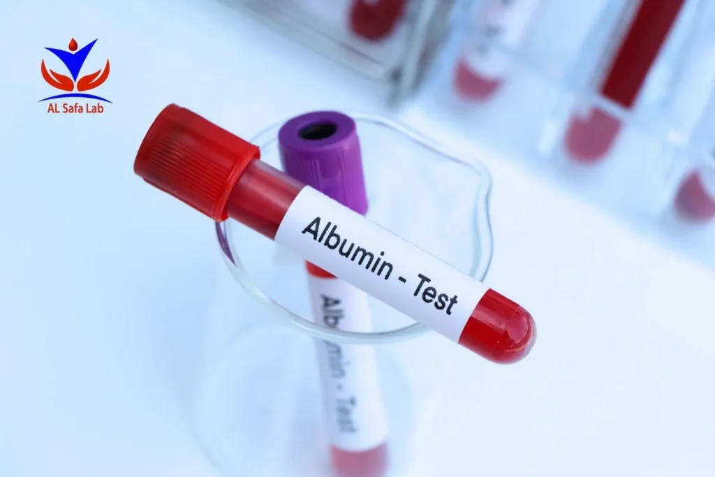 albumin