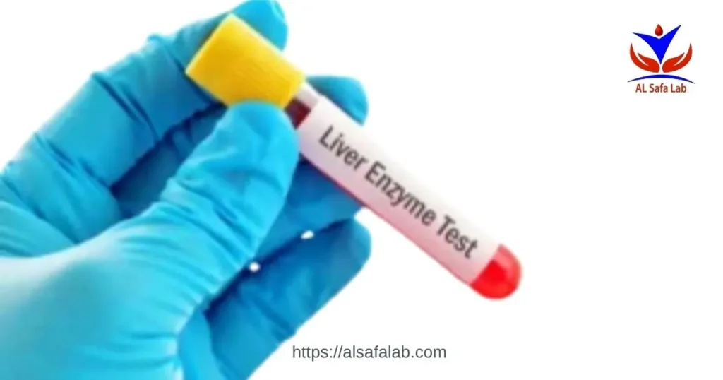 Liver Enzymes High