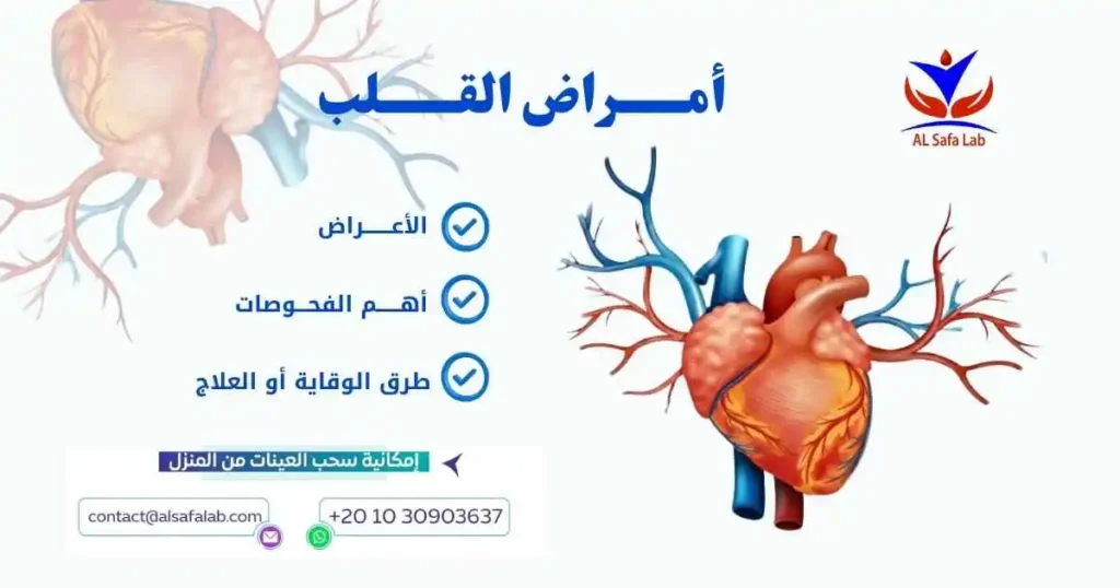 أمراض القلب