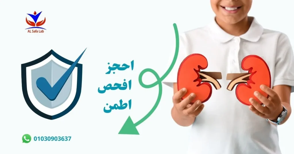 حصى الكلى