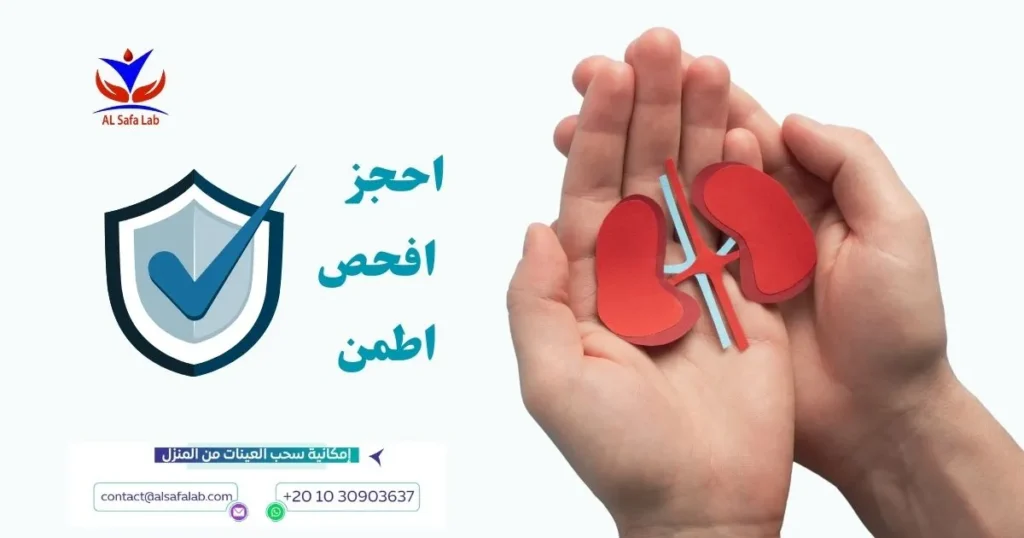 حصى الكلى