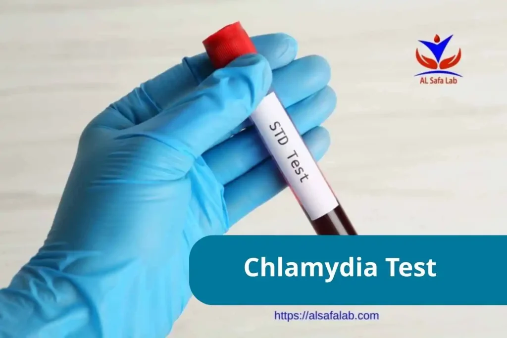 Chlamydia Test Price
