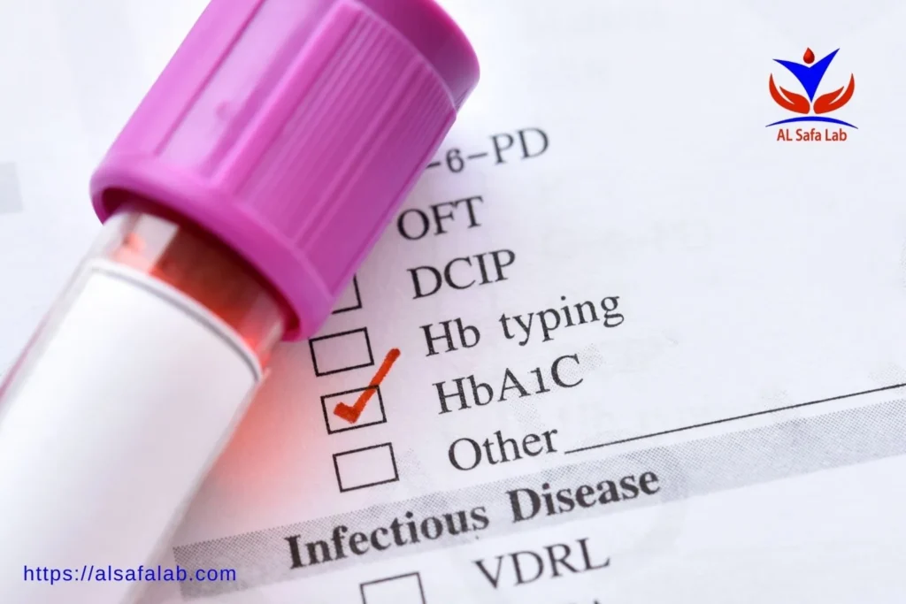 HbA1c Test