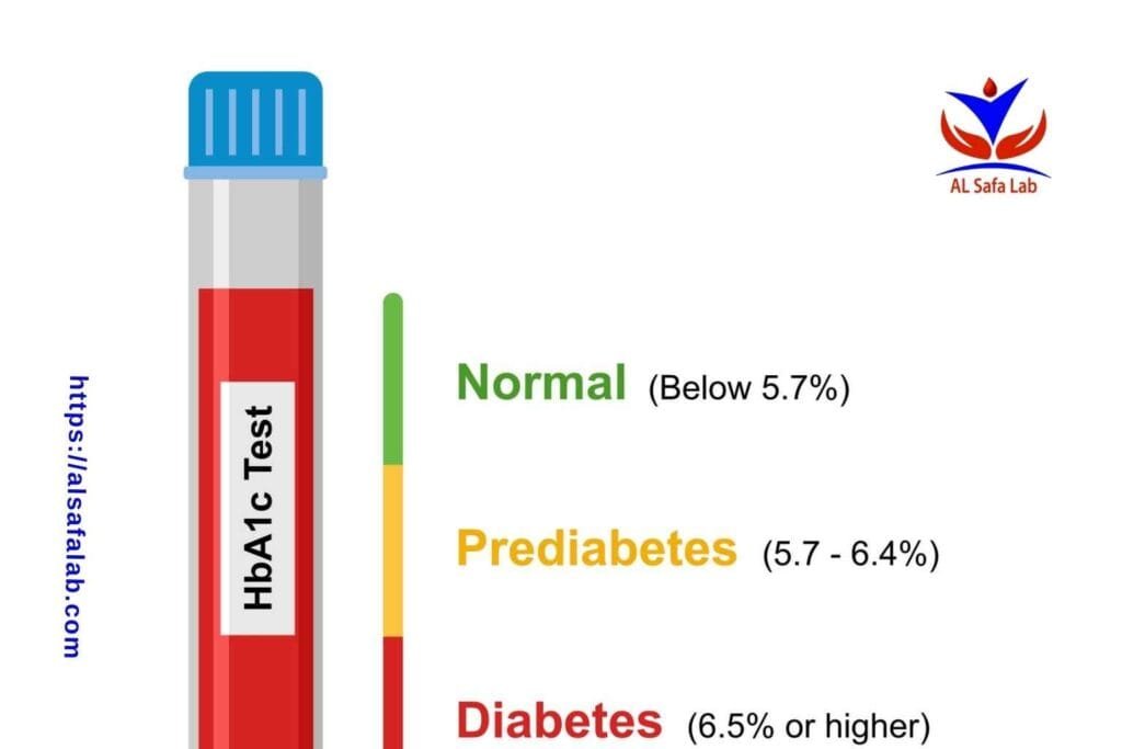 HbA1c Test Fasting