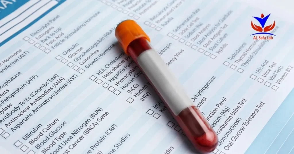 Hemoglobin Electrophoresis Test