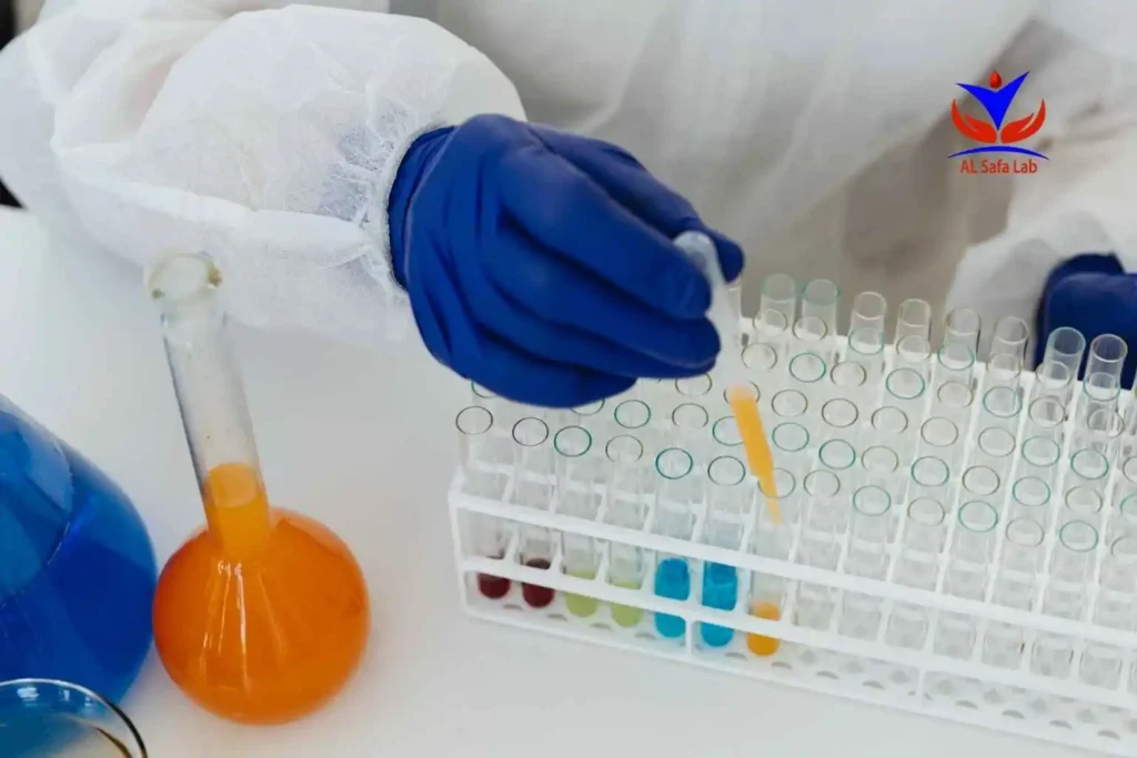 تحليل Homocysteine