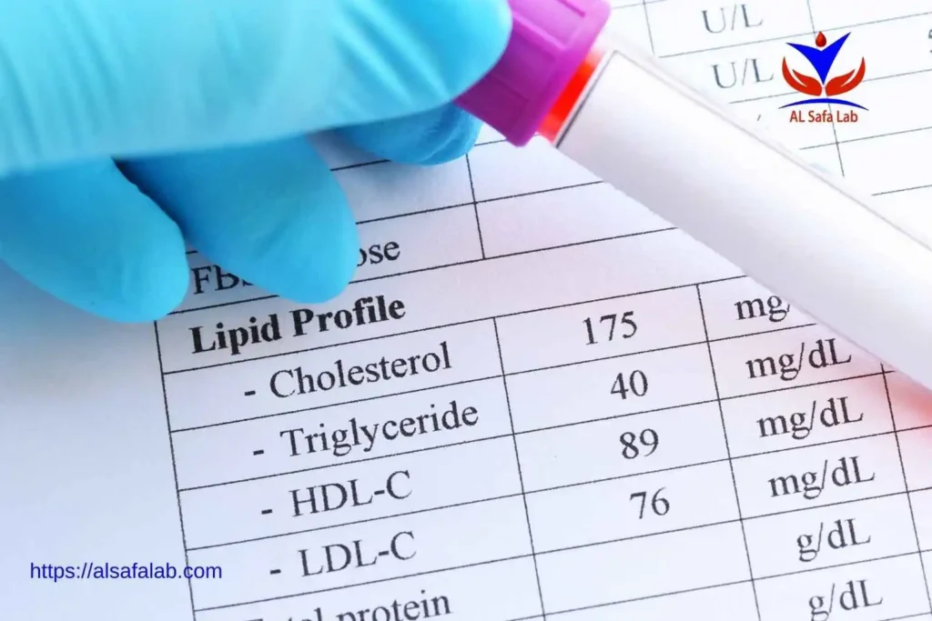 تحليل lipid profile