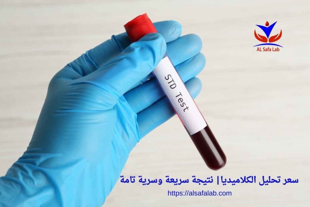 سعر تحليل الكلاميديا
