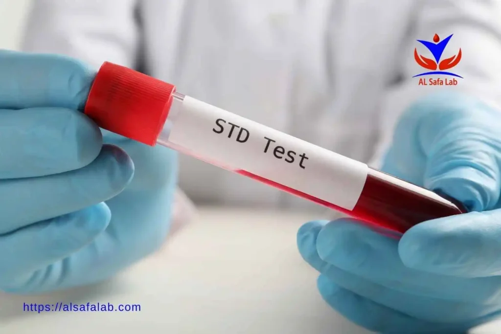 Confidential STD Testing in Egypt