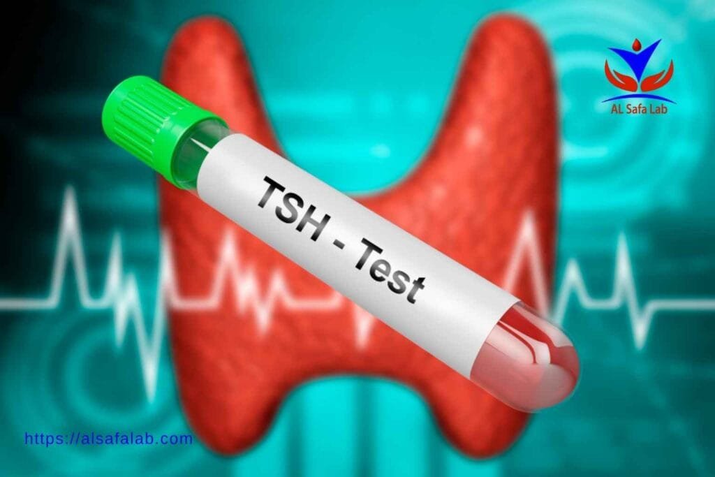 TSH Blood Test