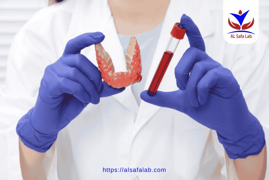 TSH Blood Test