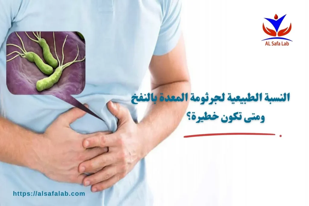 النسبة الطبيعية لجرثومة المعدة بالنفخ