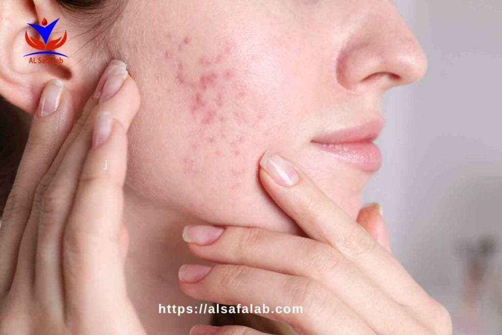 Hormonal Imbalance Symptoms in Women
