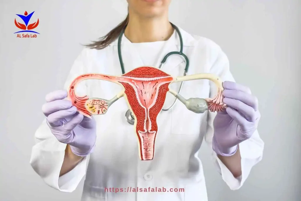 PCOS Tests
