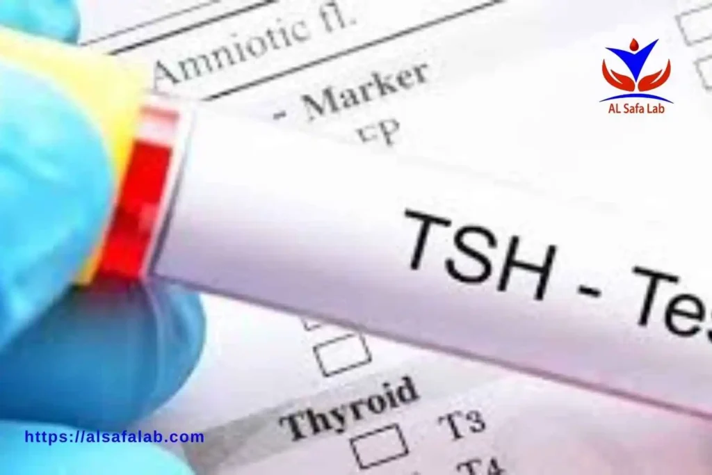 Thyroid Tests for Hypothyroidism