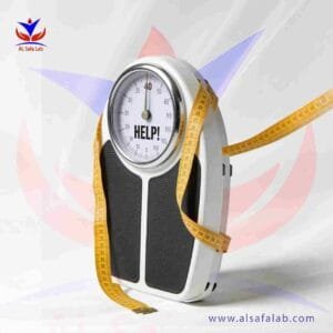 فحوصات نقص الوزن