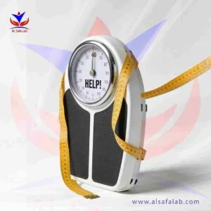 فحوصات نقص الوزن