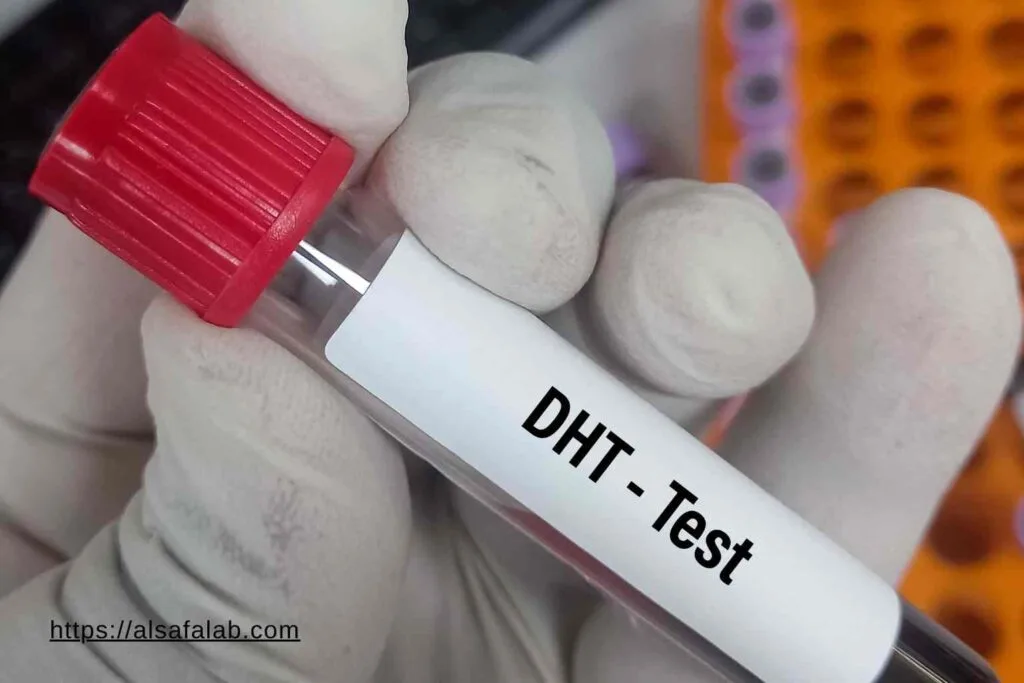 تحليل DHT