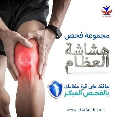 فحص هشاشة العظام