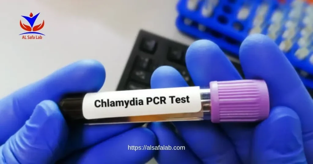 Chlamydia Trachomatis PCR