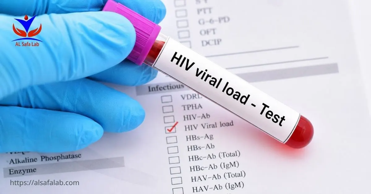 HIV RNA Quantitative PCR