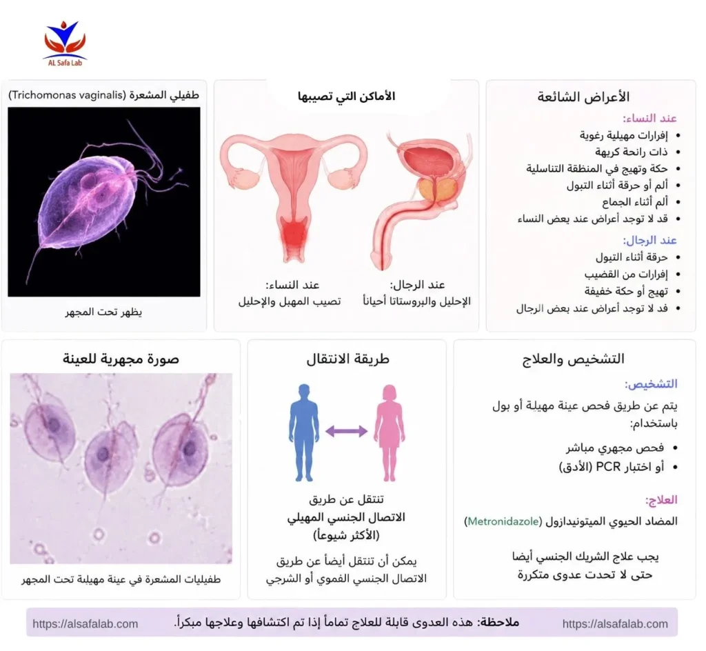 داء المشعرات Trichomoniasis