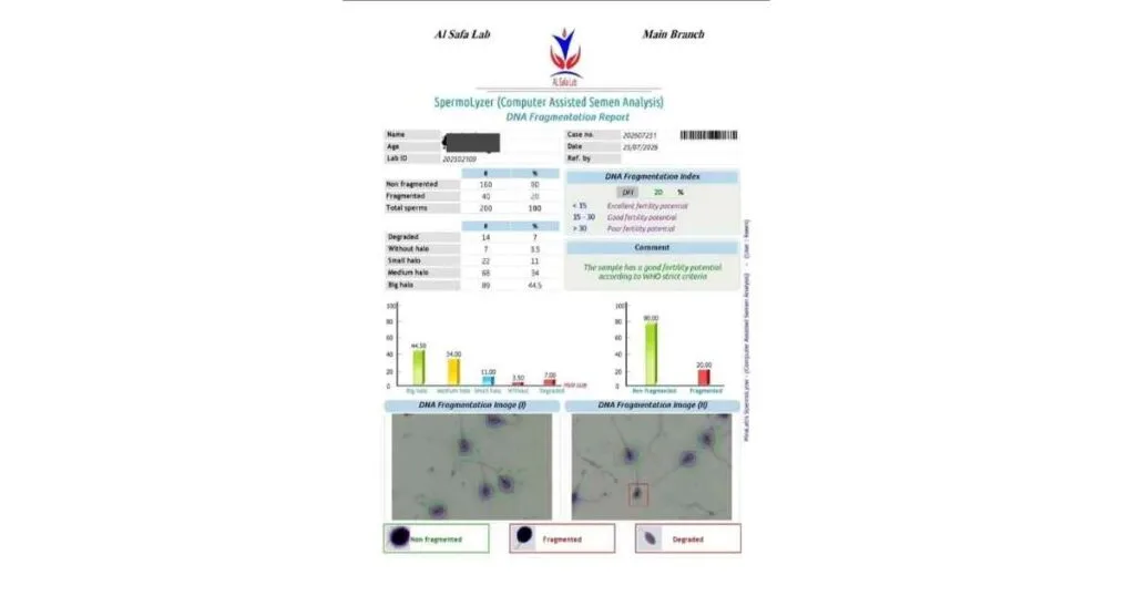 DNA Fragmentation Results