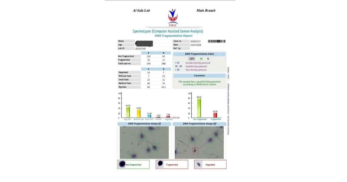 DNA Fragmentation Results